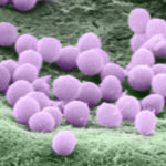 Staphylococcus em microscopia eletrônica de varredura colorizada. Foto: Vanessa Bueris