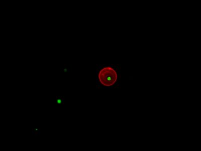 Merozoito de Plasmodium namorando uma celula vermelha
