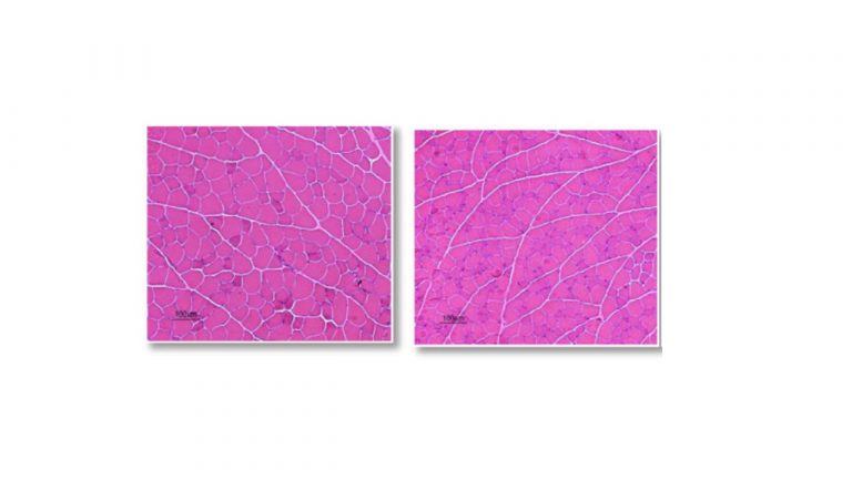 Leia mais sobre o artigo Doxorubicin caused severe hyperglycaemia and insulin resistance, mediated by inhibition in AMPk signalling in skeletal muscle