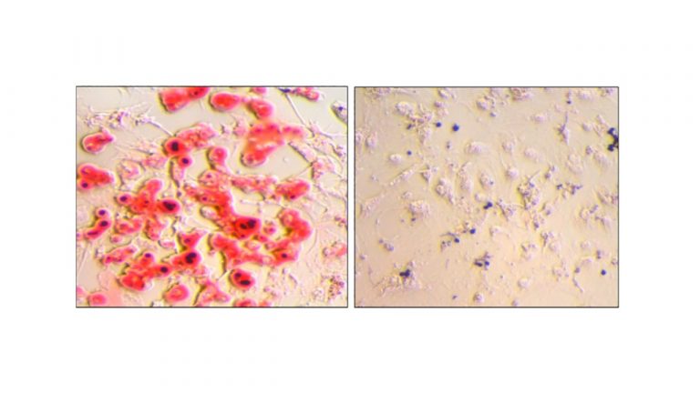 Leia mais sobre o artigo Impact of Doxorubicin Treatment on the Physiological Functions of White Adipose Tissue