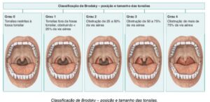 Leia mais sobre o artigo Exame Físico da Boca e da Faringe