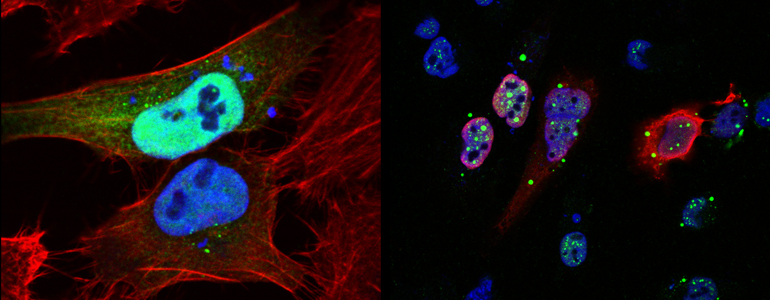 Localização  subcelular de UHMK1 em células HeLa