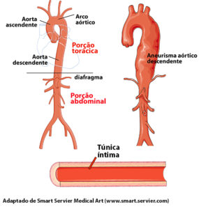 Aorta anatomy