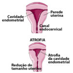 Utherus anatomy
